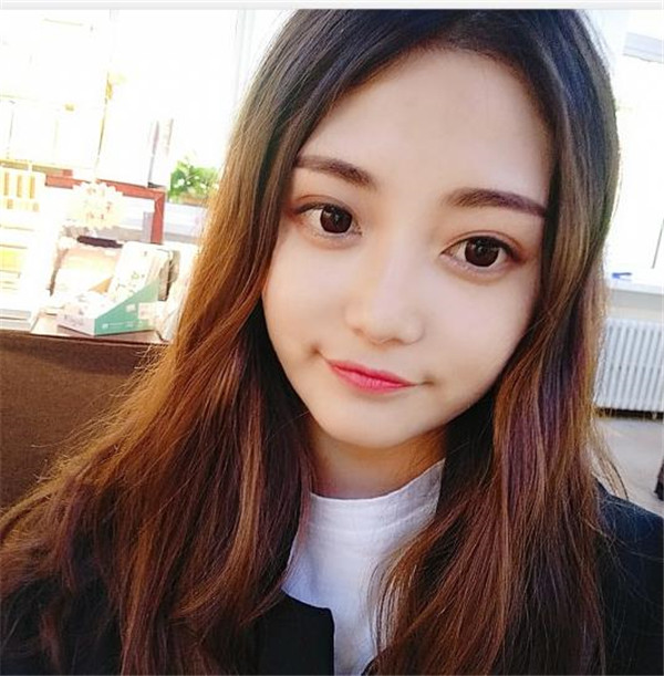 太原美媛荟冯瑞铮双眼皮怎么样?价格案例