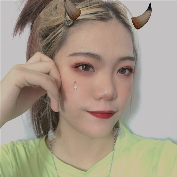 北京邦定张艳华双眼皮怎么样?价格案例