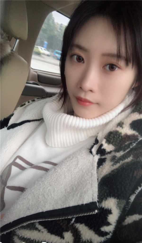 上海华美张朋脂肪丰额头怎么样?价格案例