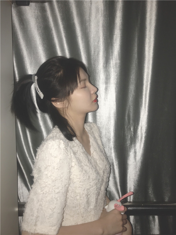 绍兴越城歆菲吴建利双眼皮怎么样?价格案例