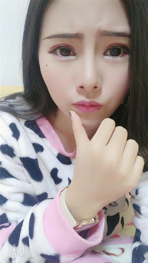 重庆瑞俪医院胡小义双眼皮怎么样?价格案例