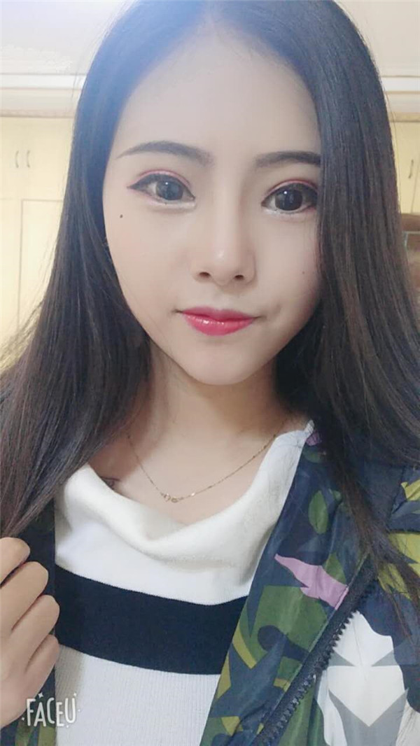 重庆瑞俪医院胡小义双眼皮怎么样?价格案例