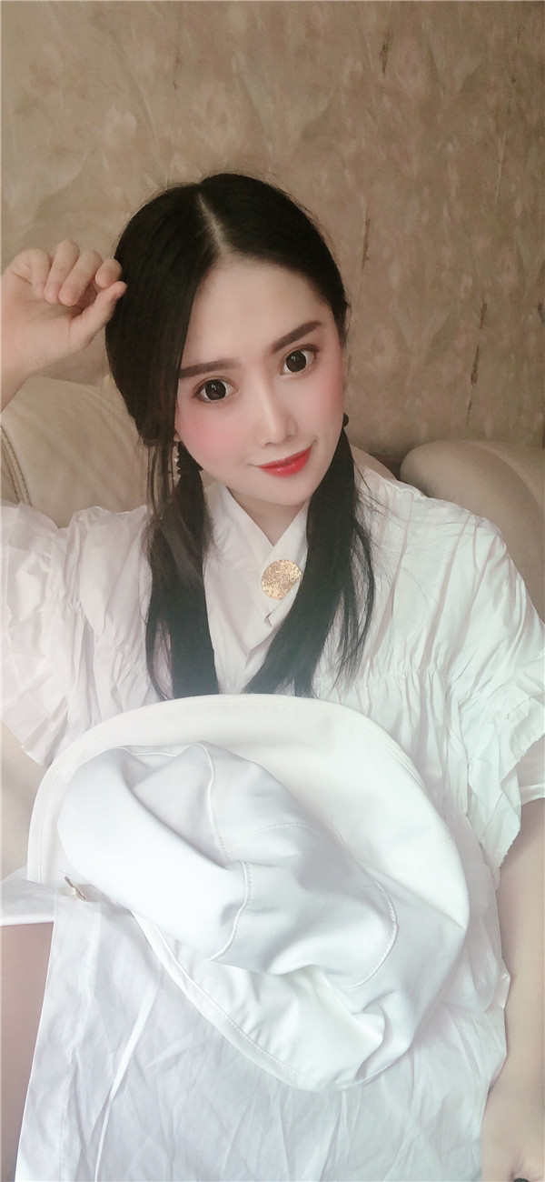 重庆瑞俪陈继超割双眼皮怎么样?价格案例