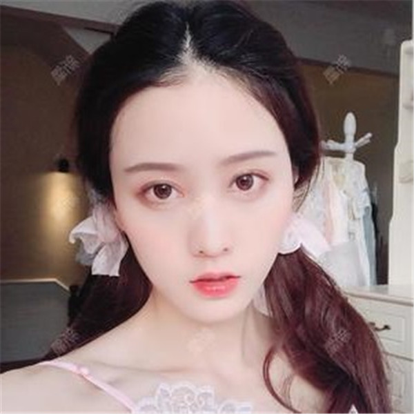 武汉汉秀医院吴明瑞眼部整形怎么样?价格案例