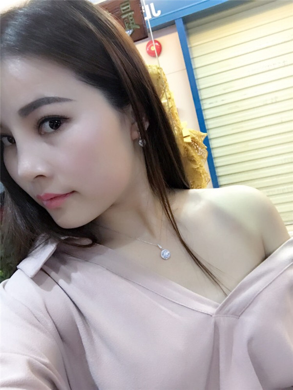 长春中妍王纳切开双眼皮怎么样?价格案例