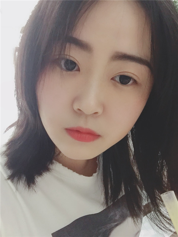 成都艺星蔡灵双眼皮怎么样?价格案例