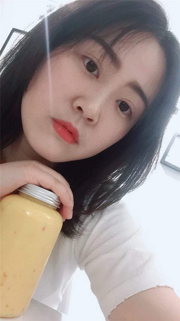 成都艺星蔡灵双眼皮怎么样?价格案例