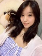 昆明梦想整形李成龙眼部综合怎么样？价格案例