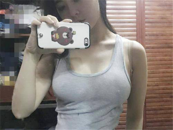 济宁名美脂肪隆胸怎么样?价格案例