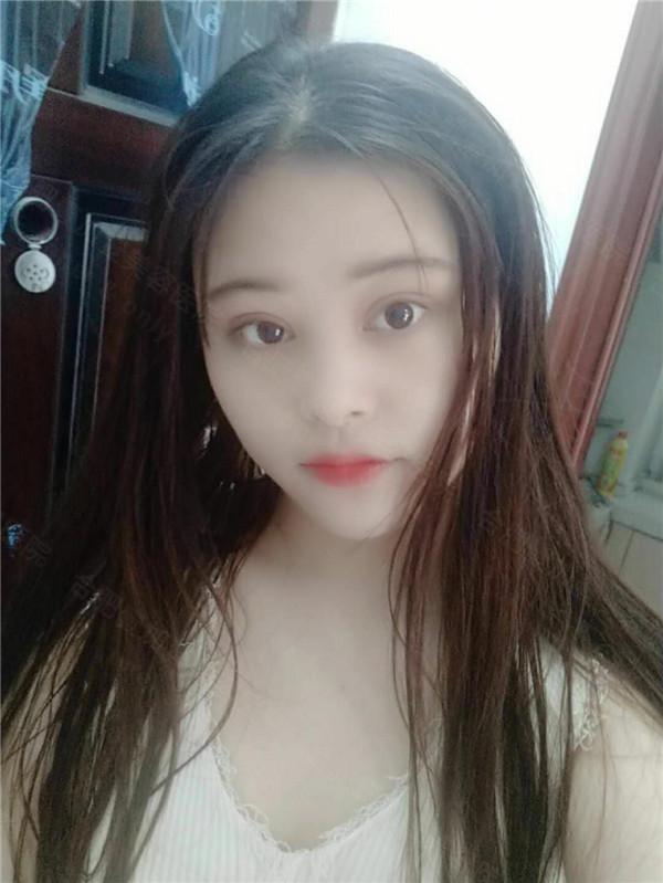合肥壹加壹孟松上睑提肌怎么样?价格案例