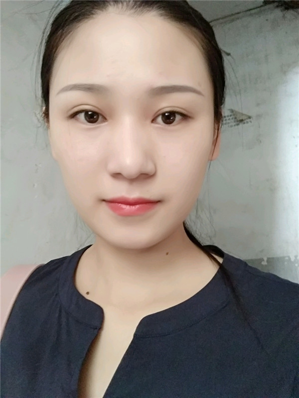 济南隅美张科军水光补水怎么样?价格案例