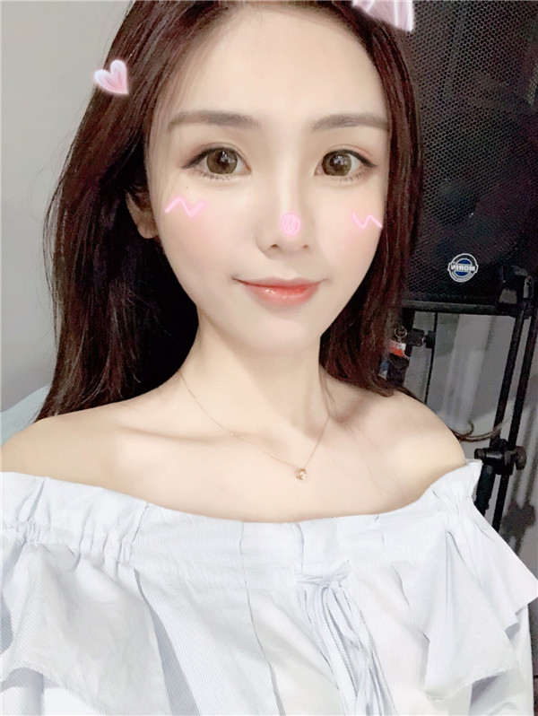 宁波薇琳雷艳莉眼部综合怎么样?价格案例