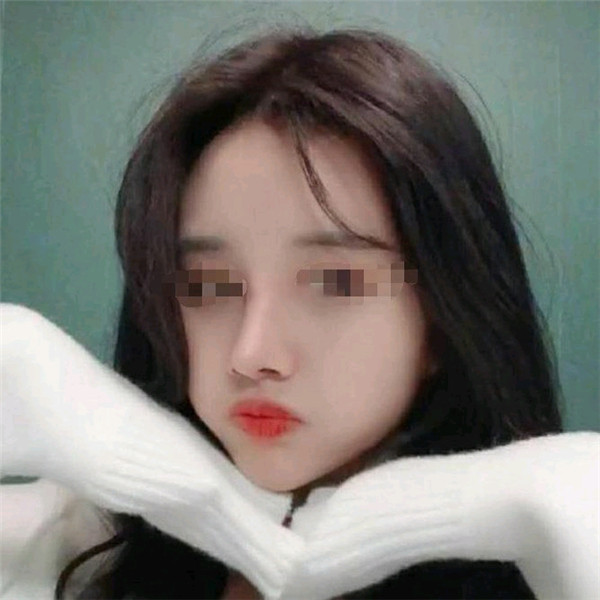 台州博雅美惠王大明隆鼻怎么样?价格案例