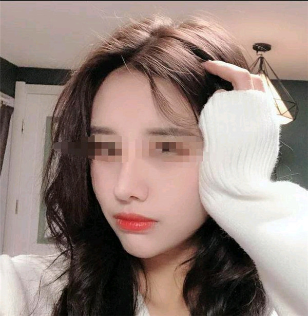 台州博雅美惠王大明隆鼻怎么样?价格案例