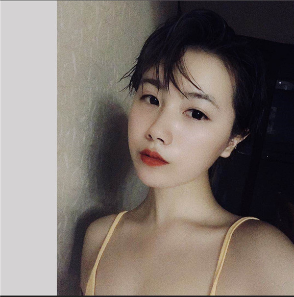 成都天姿李烈脂肪填充怎么样?价格案例