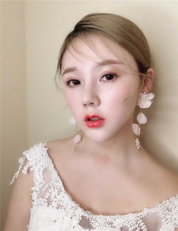 长春中妍微整形怎么样?价格案例