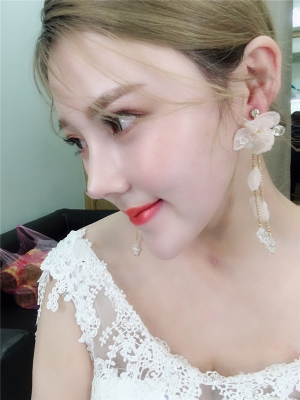 长春中妍微整形怎么样?价格案例