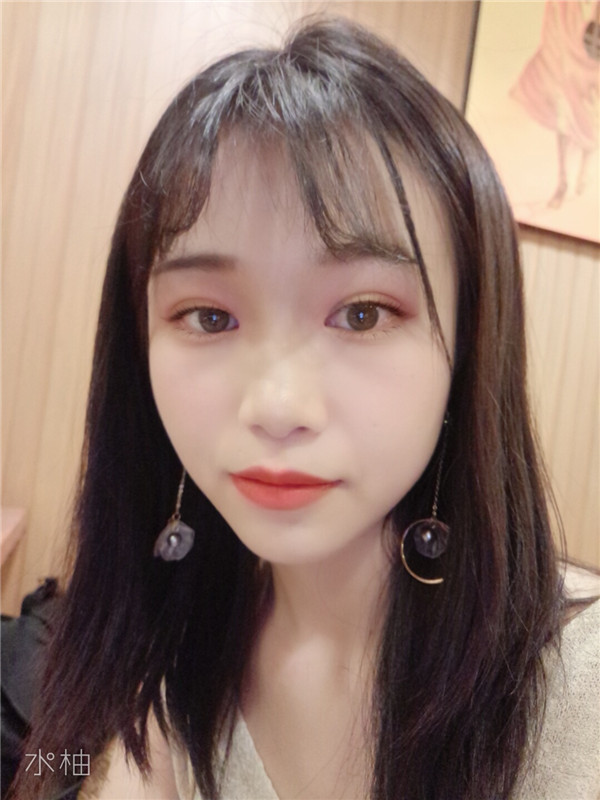 云南华美美莱李韬切开双眼皮怎么样?价格案例