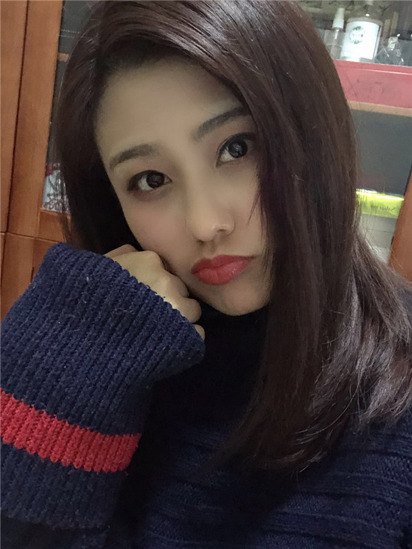 鞍山齐敏割双眼皮怎么样?价格案例