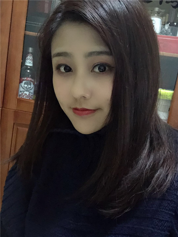 鞍山齐敏割双眼皮怎么样?价格案例
