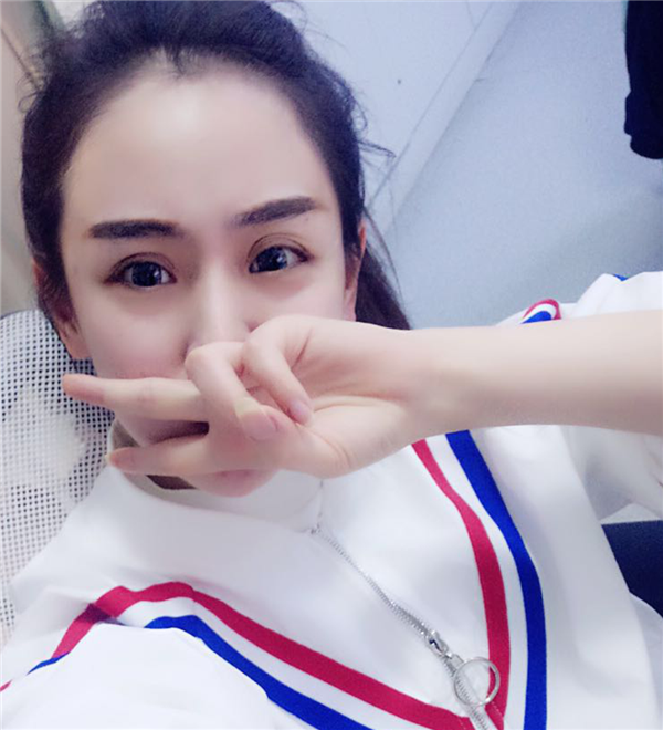 岛亚美妍安翔脂肪丰额头怎么样?价格案例