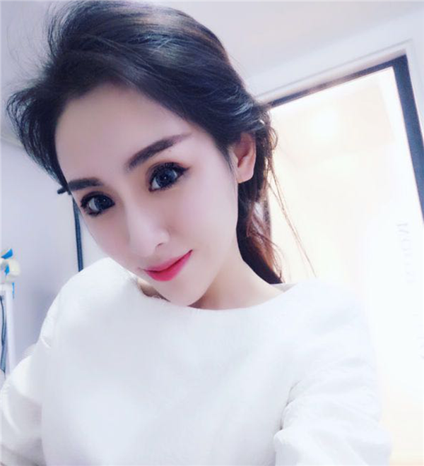 岛亚美妍安翔脂肪丰额头怎么样?价格案例