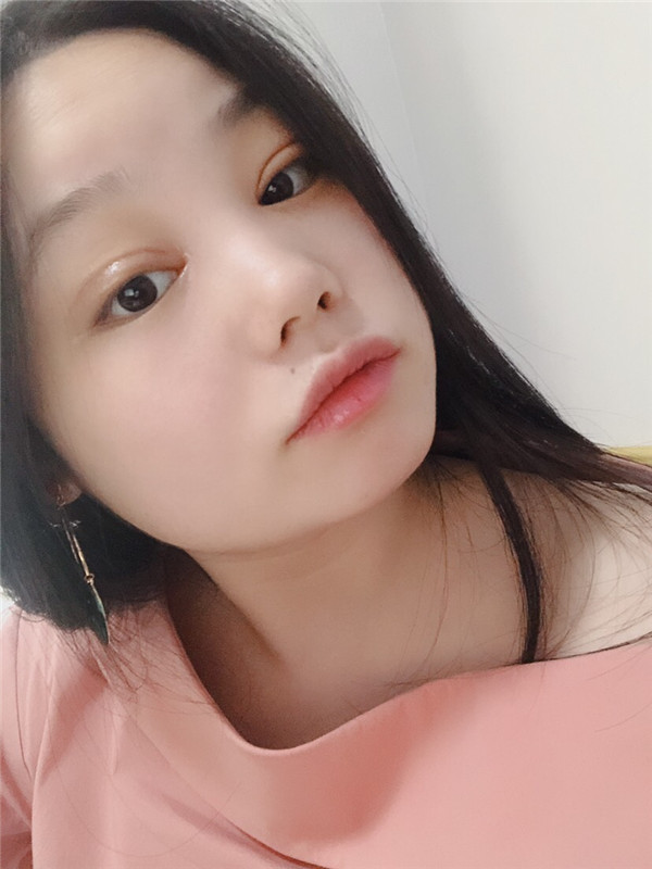 重庆奥妃莫让伟埋线双眼皮怎么样?价格案例