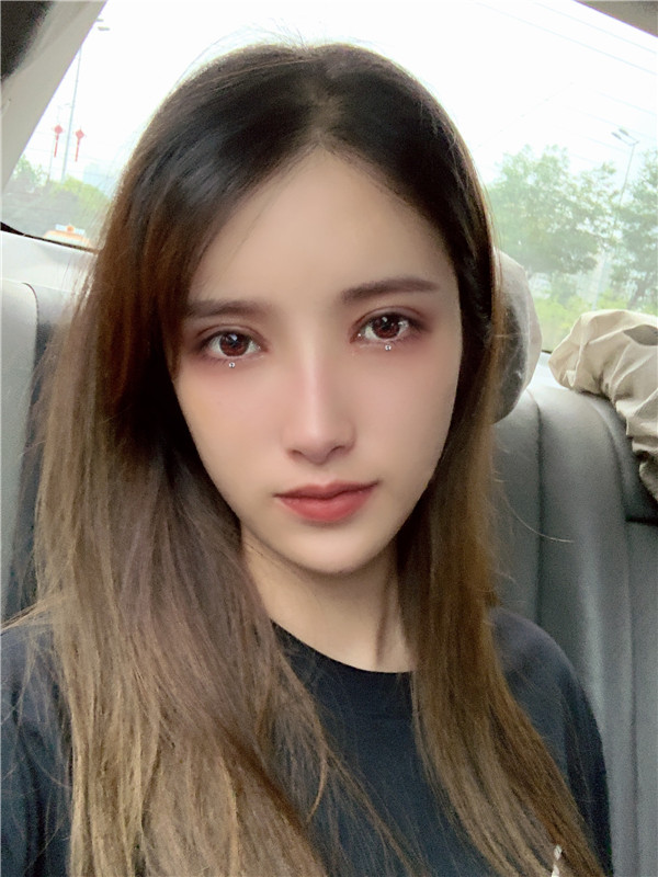 成都美上美罗通贵眼部修复怎么样?价格案例