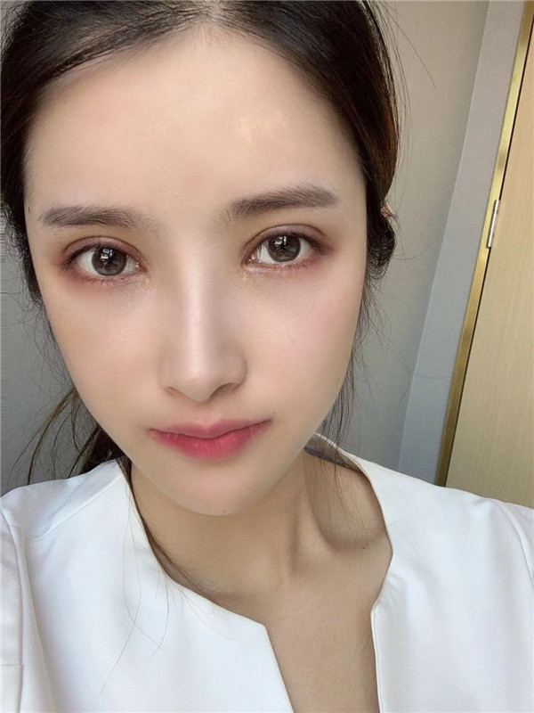 成都美上美罗通贵眼部修复怎么样?价格案例