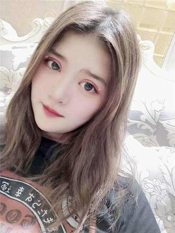 梁园冰薇医疗诊所张帅兵双眼皮怎么样?价格案例