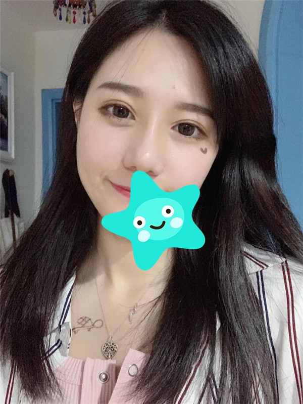 台州博雅美惠王大明鼻部手术怎么样?价格案例