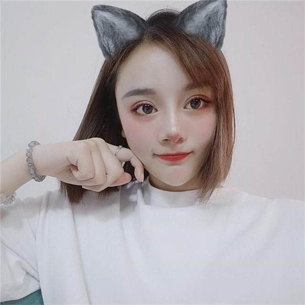 重庆新铜雀台王杰切开双眼皮怎么样?价格案例