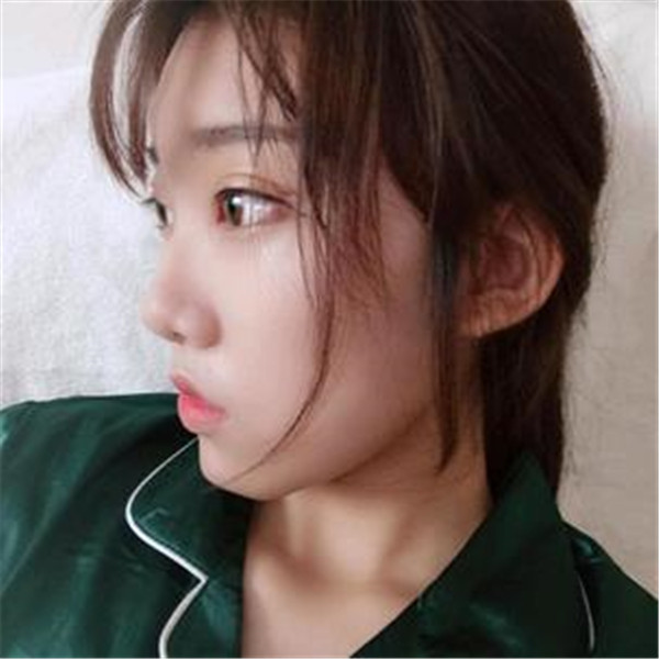 杭州新清吟孙敏捷埋线双眼皮怎么样?价格案例