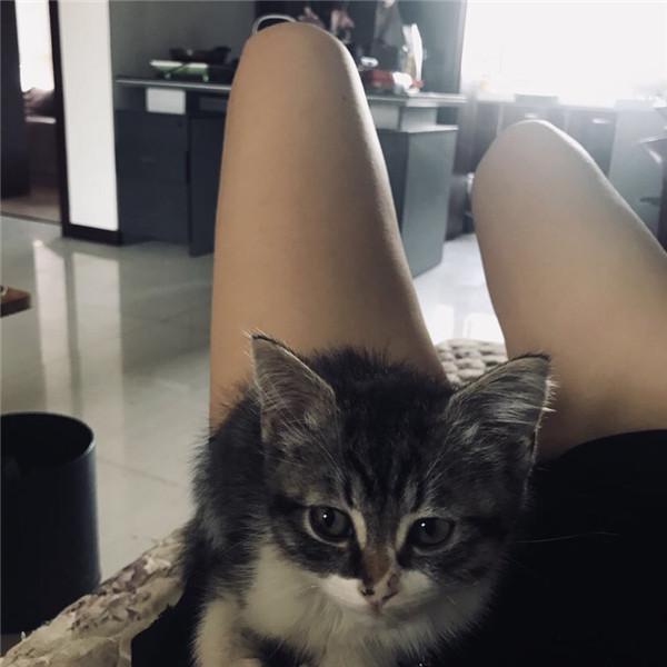 昆明梦想整形医院李成龙大腿吸脂怎么样?价格案例