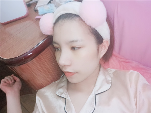医疗张宏鼻部手术怎么样?价格案例