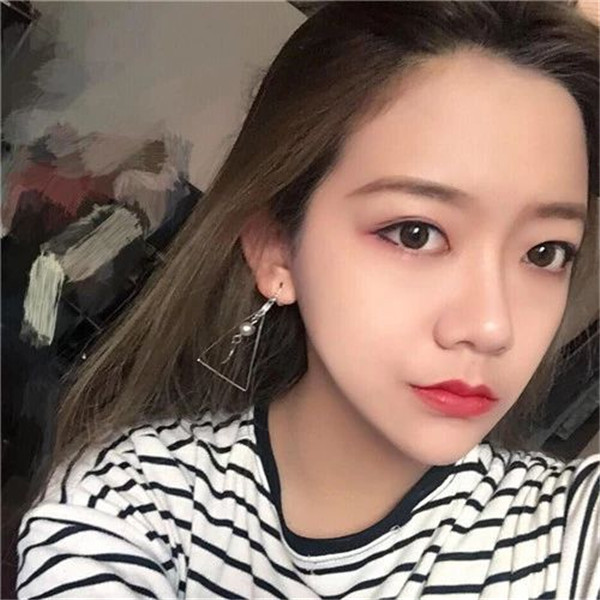 武汉中翰朱红霞双眼皮怎么样?价格案例