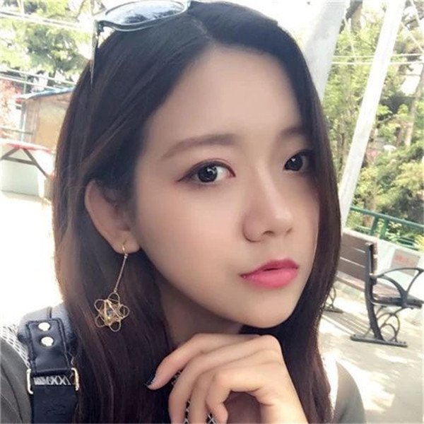 武汉中翰朱红霞双眼皮怎么样?价格案例