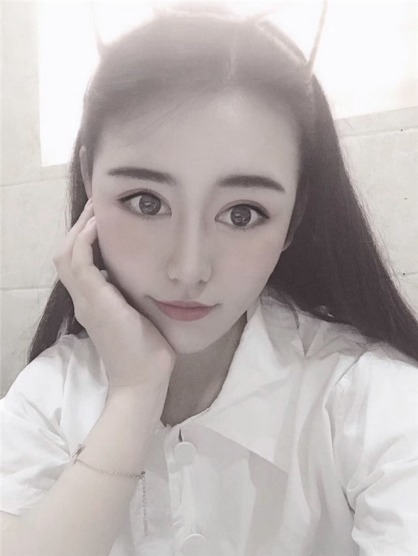 亳州缔莱美杜海宽去眼袋怎么样?价格案例