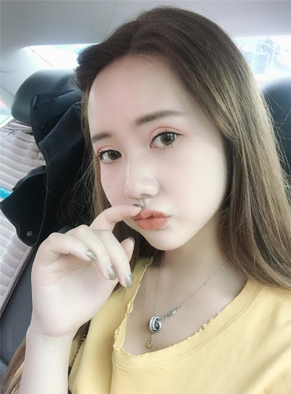 合肥壹美尚整形医院眼部手术怎么样?价格案例