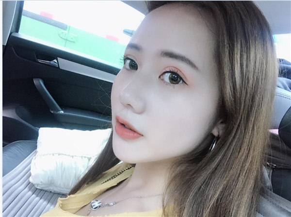 合肥壹美尚整形医院眼部手术怎么样?价格案例