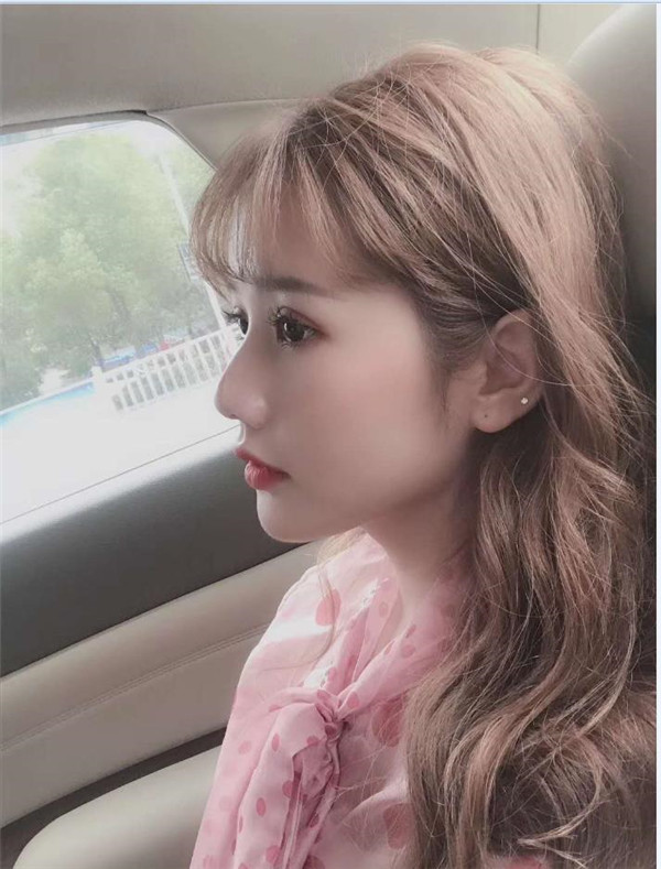 合肥壹美尚整形医院眼部手术怎么样?价格案例