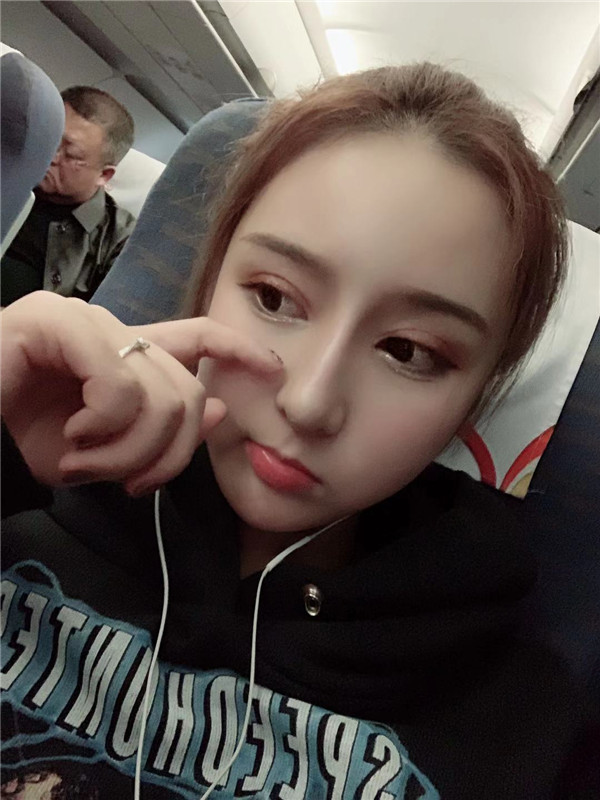 成都素美医疗卢元刚隆鼻怎么样?价格案例