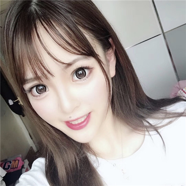 无锡施尔美辛倩鸿双眼皮怎么样?价格案例