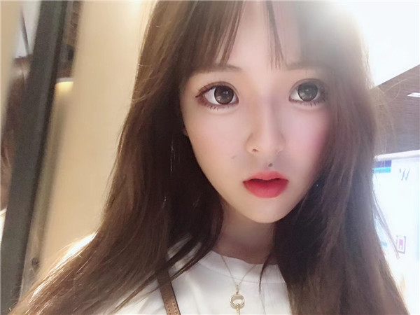无锡施尔美辛倩鸿双眼皮怎么样?价格案例