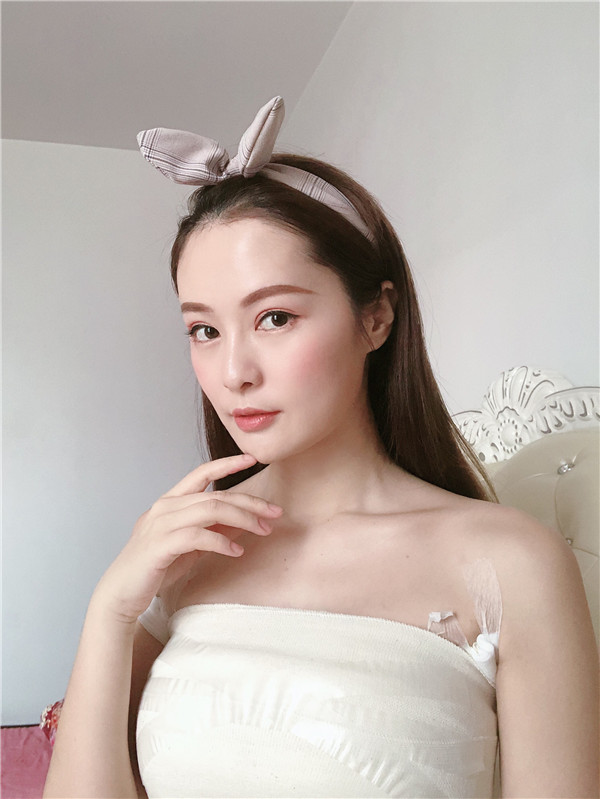 广州曙光刘杰伟隆胸怎么样?价格案例