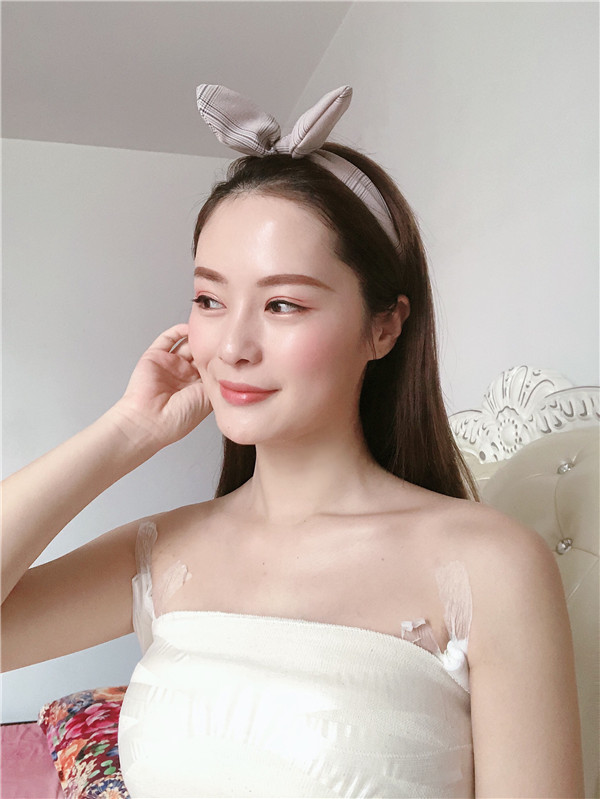广州曙光刘杰伟隆胸怎么样?价格案例