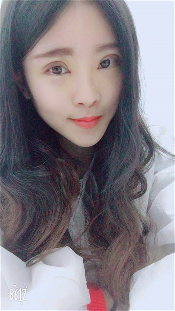 长春中妍双眼皮怎么样?价格案例