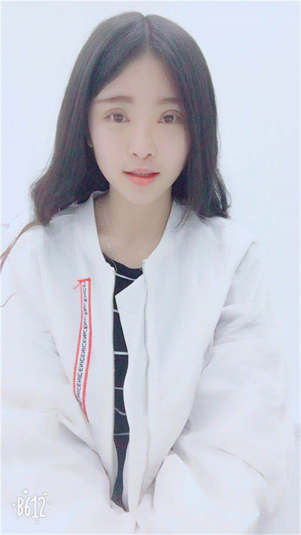 长春中妍双眼皮怎么样?价格案例