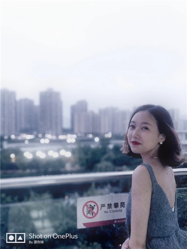 山西省整形外科刘晋元脂肪丰太阳穴怎么样?价格案例