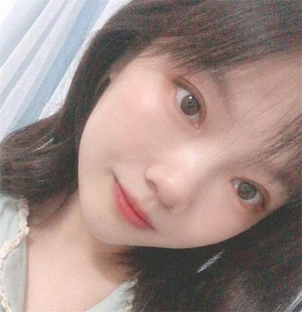台州博雅美惠王大明双眼皮怎么样?价格案例